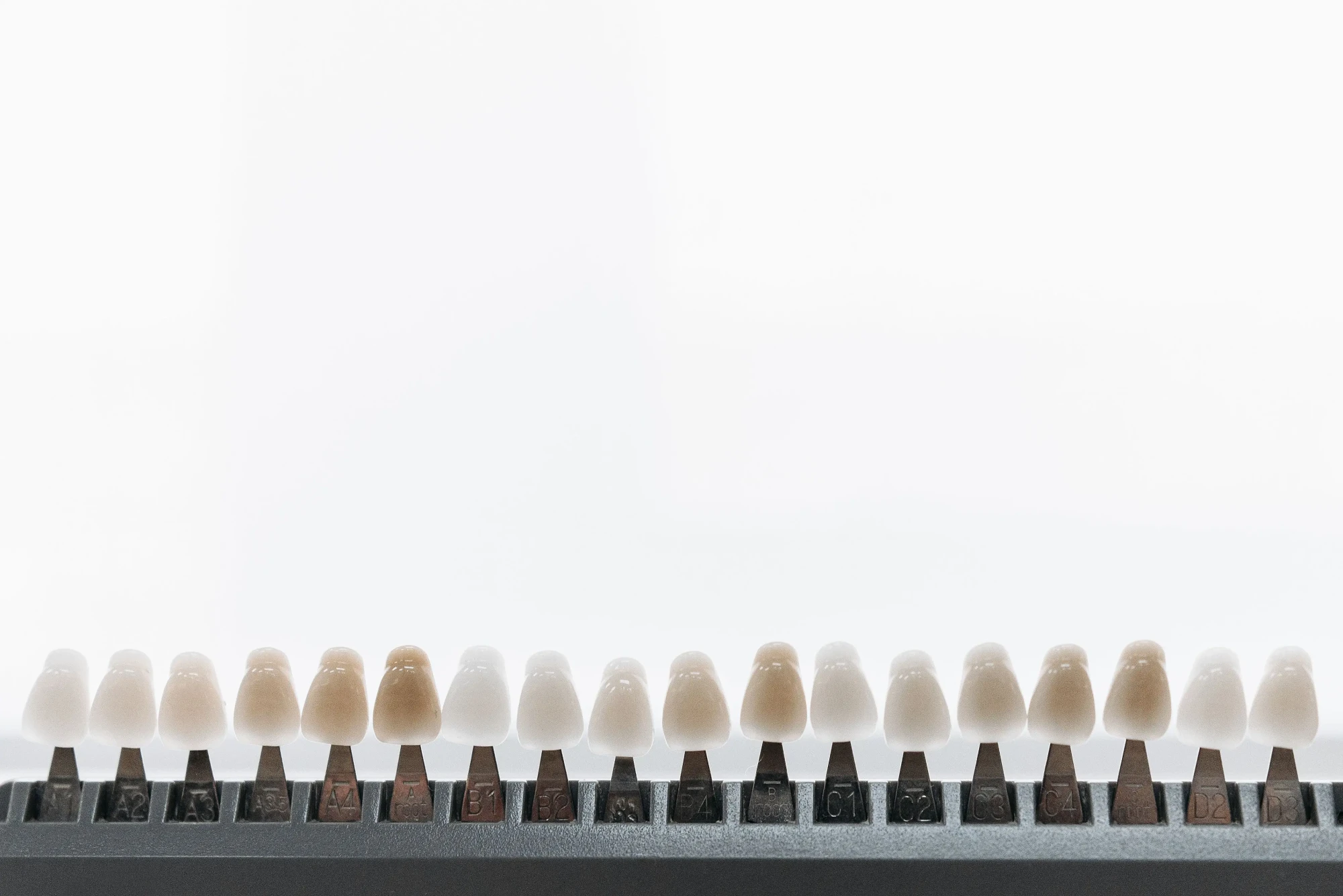 Estetică dentară – Brașov, fațete ceramice CEREC